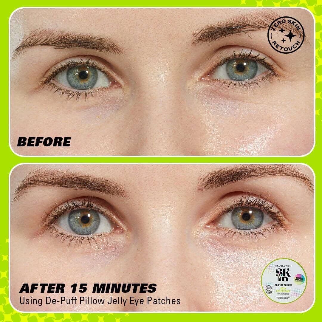 Revolution Skin De-Puff Pillow Hyaluronic Acid Jelly Eye Patches