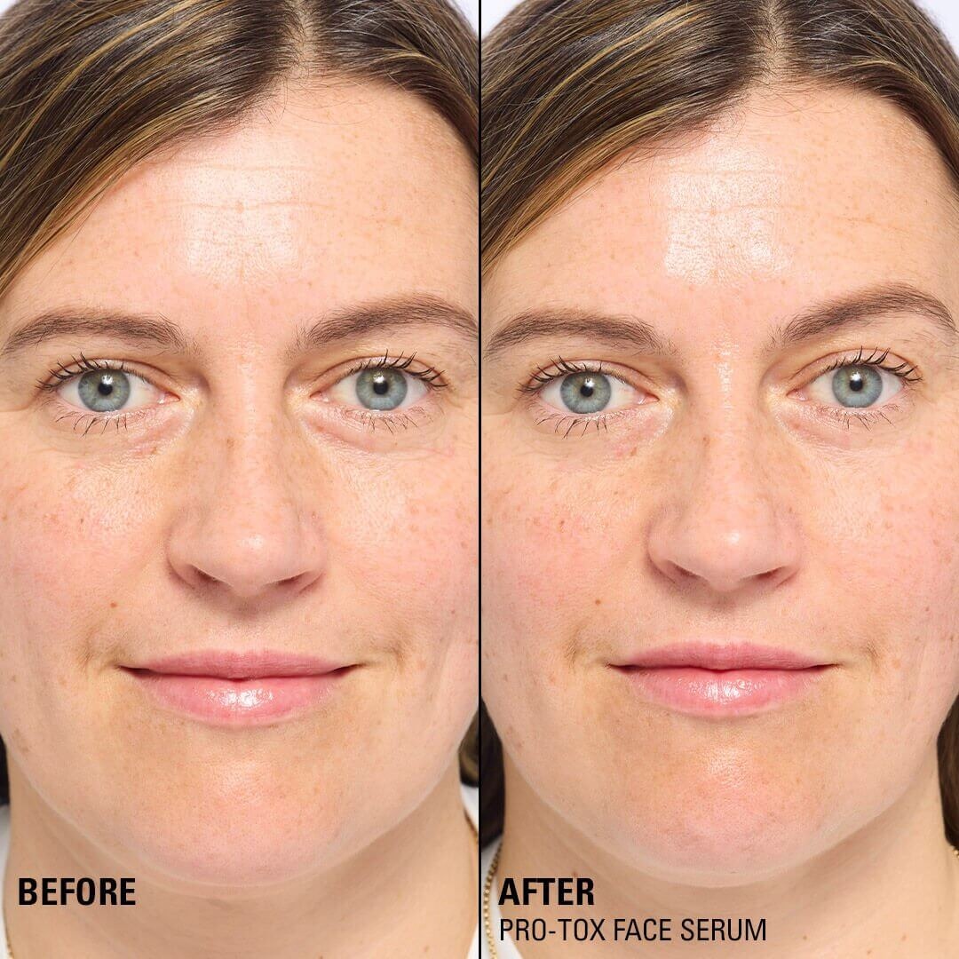 Revolution Pro Miracle Pro-Tox Fine Line Fix & Fill Serum